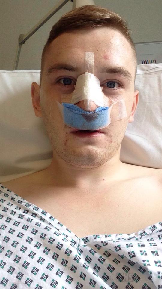 Medical Photo for: Benjamin Newton (24/04/1991)
