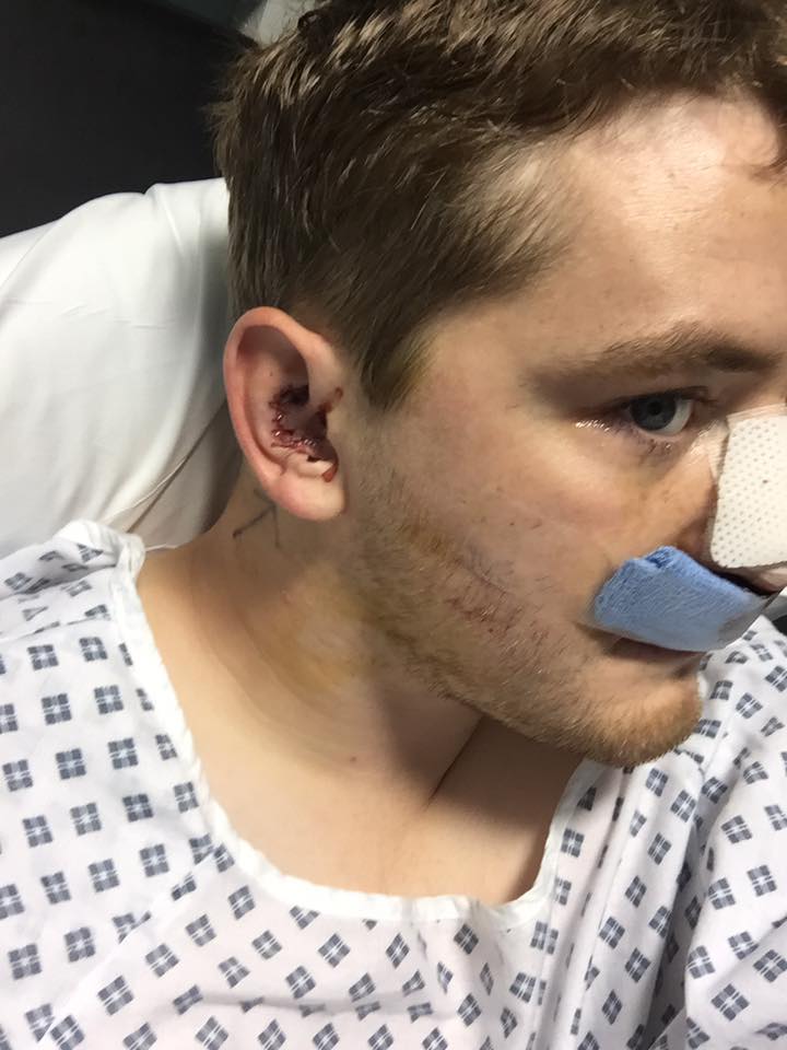 Medical Photo for: Benjamin Newton (24/04/1991)