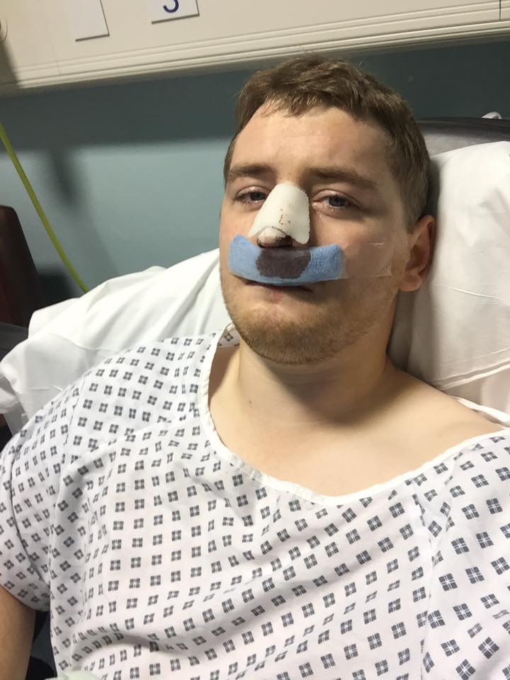 Medical Photo for: Benjamin Newton (24/04/1991)