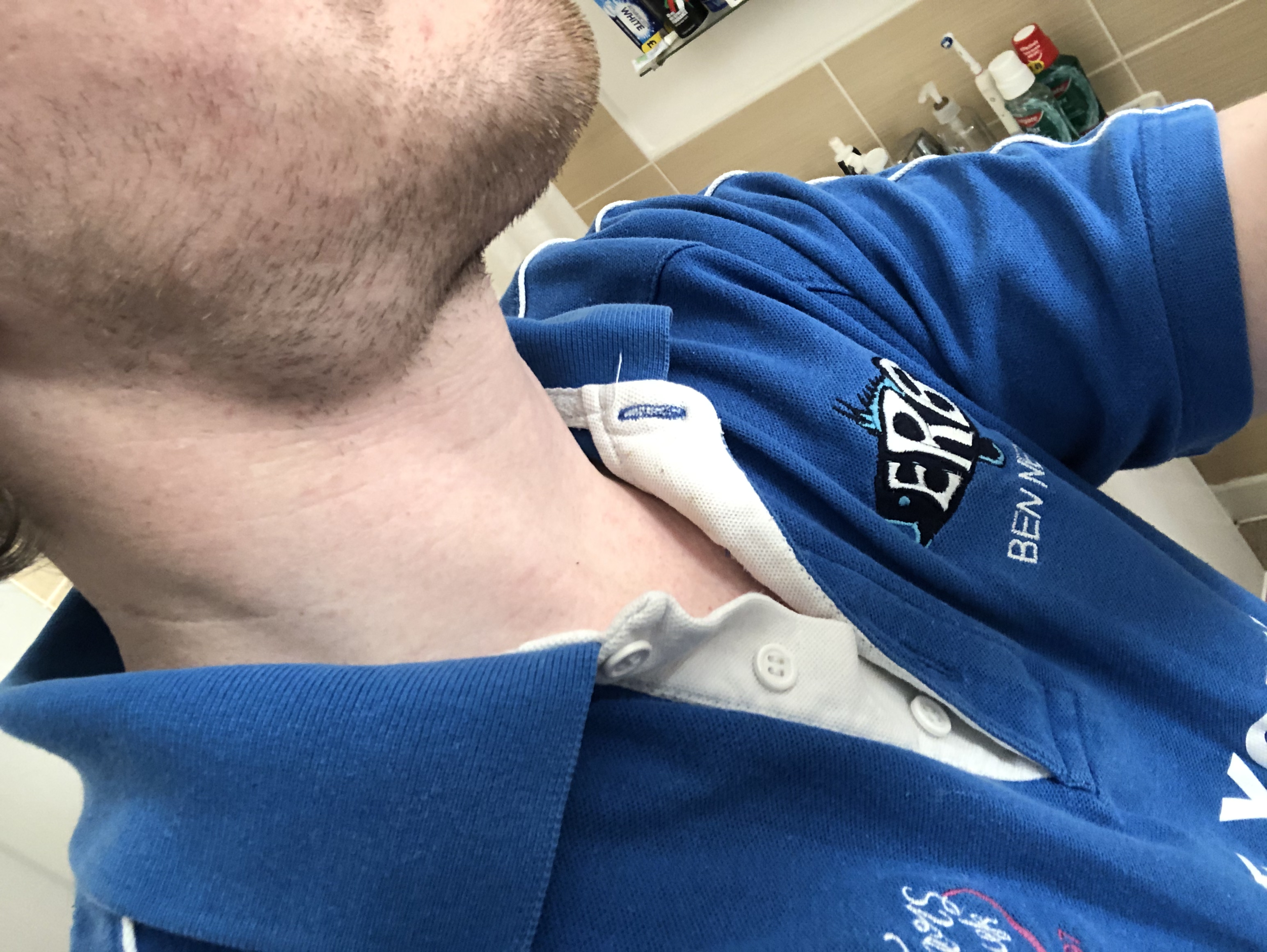 Medical Photo for: Benjamin Newton (24/04/1991)