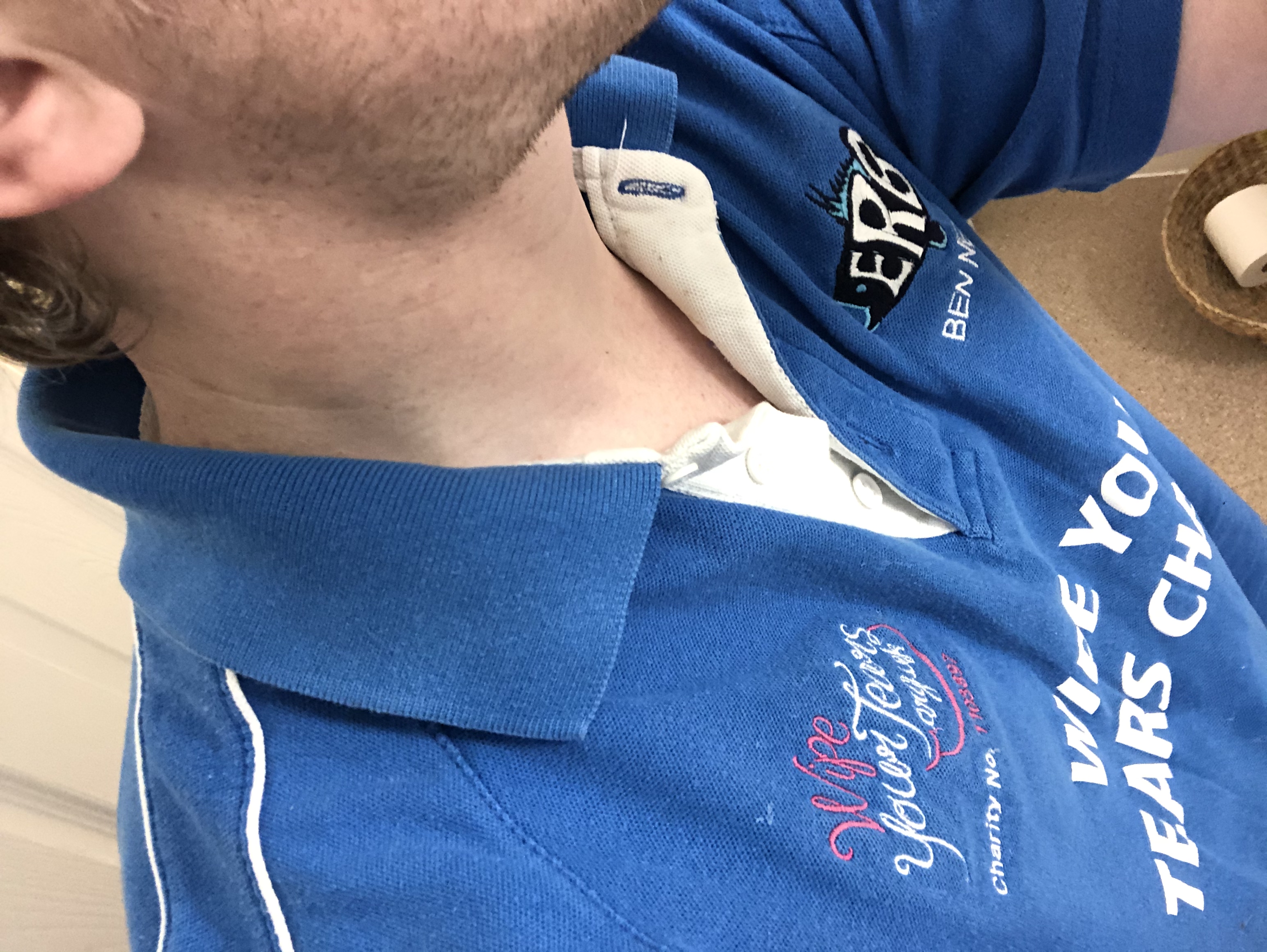 Medical Photo for: Benjamin Newton (24/04/1991)